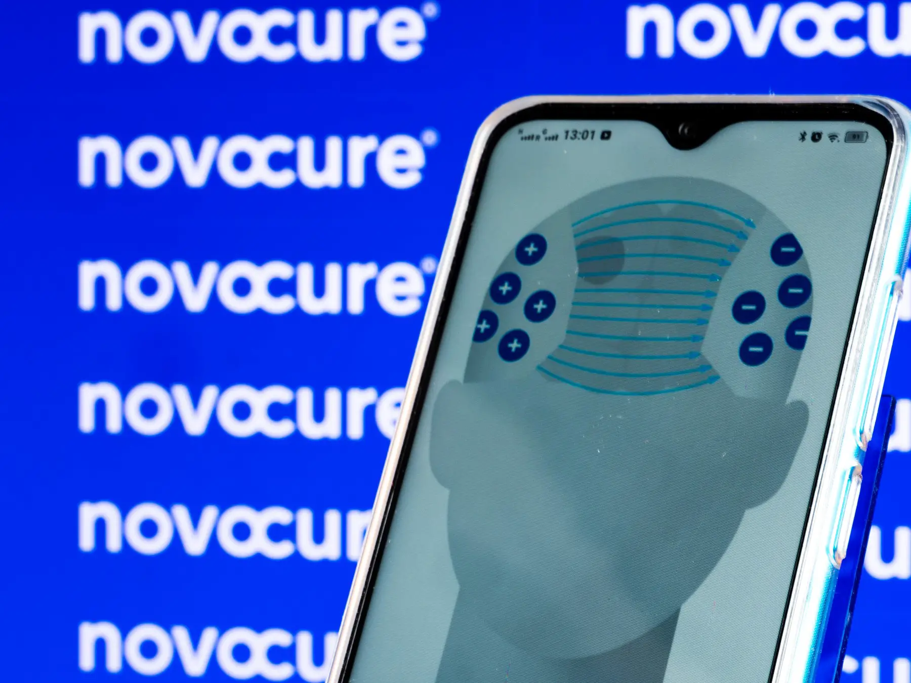 Novocure app owned by Hansjoerg Wyss 