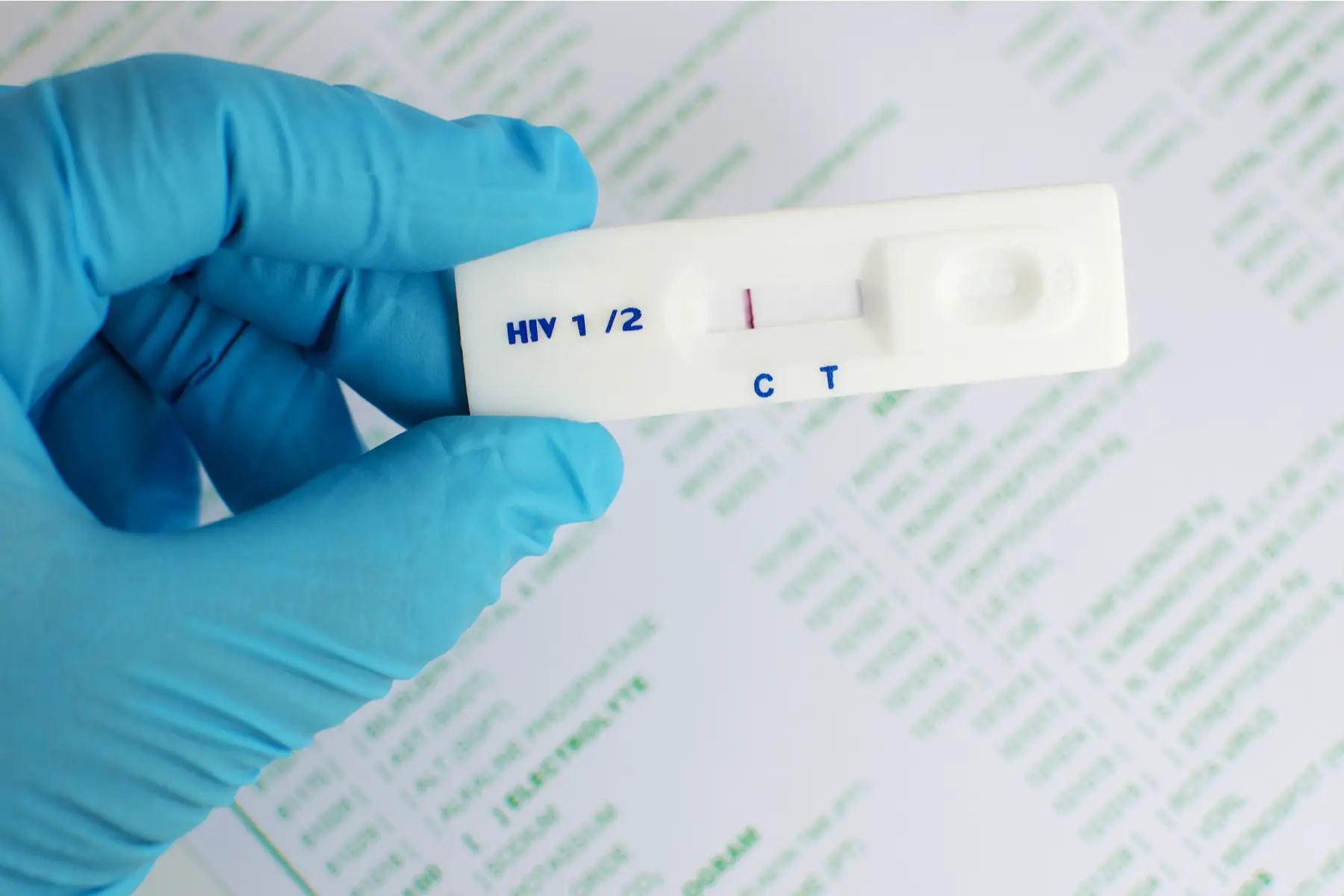 close-up of an HIV test result