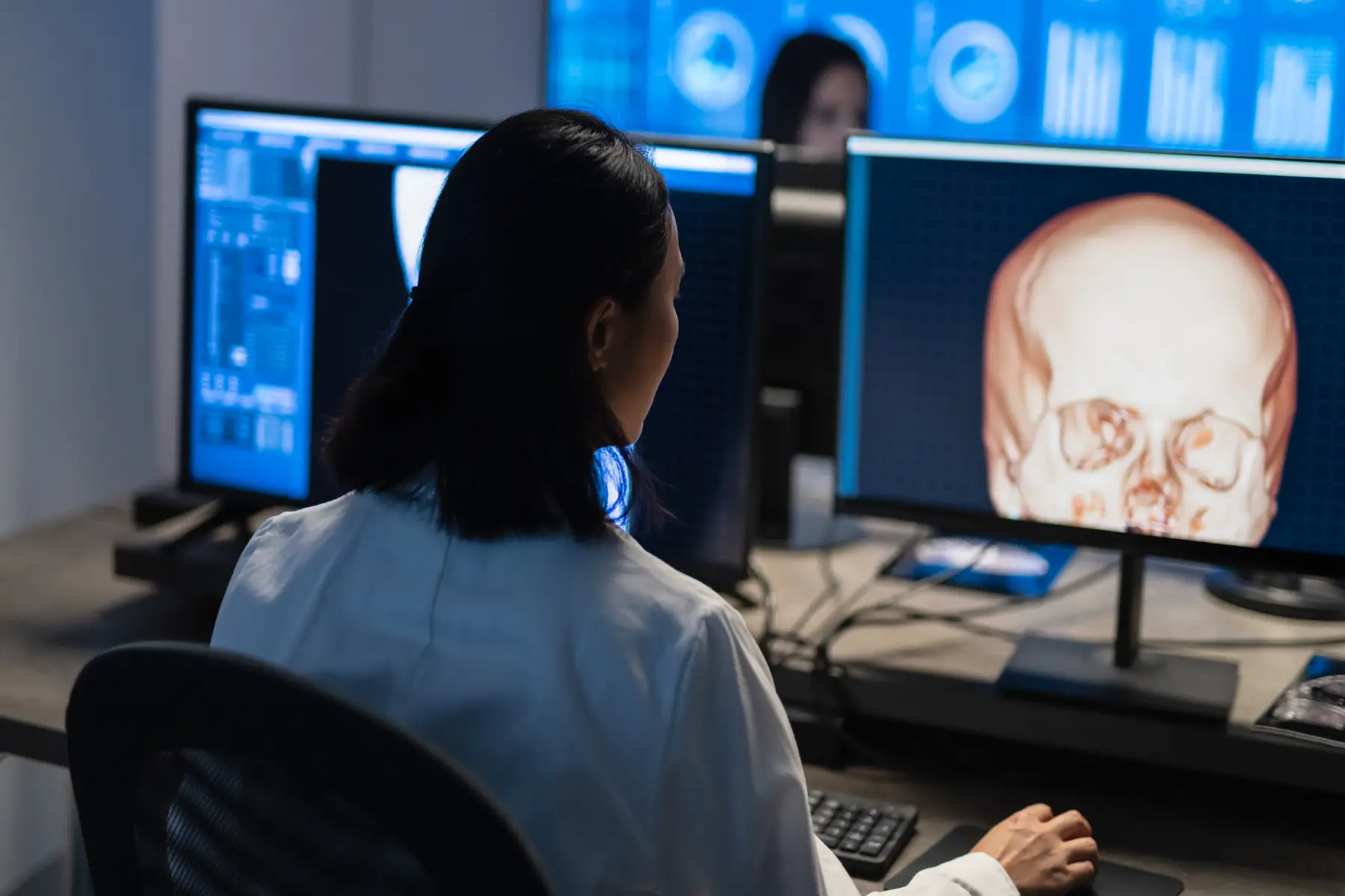 Medical specialist looking at brain and scull scans on a computer monitor