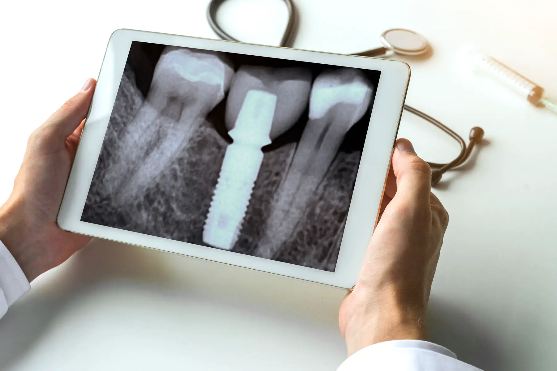 Luxembourg dentists: a dental X-ray image