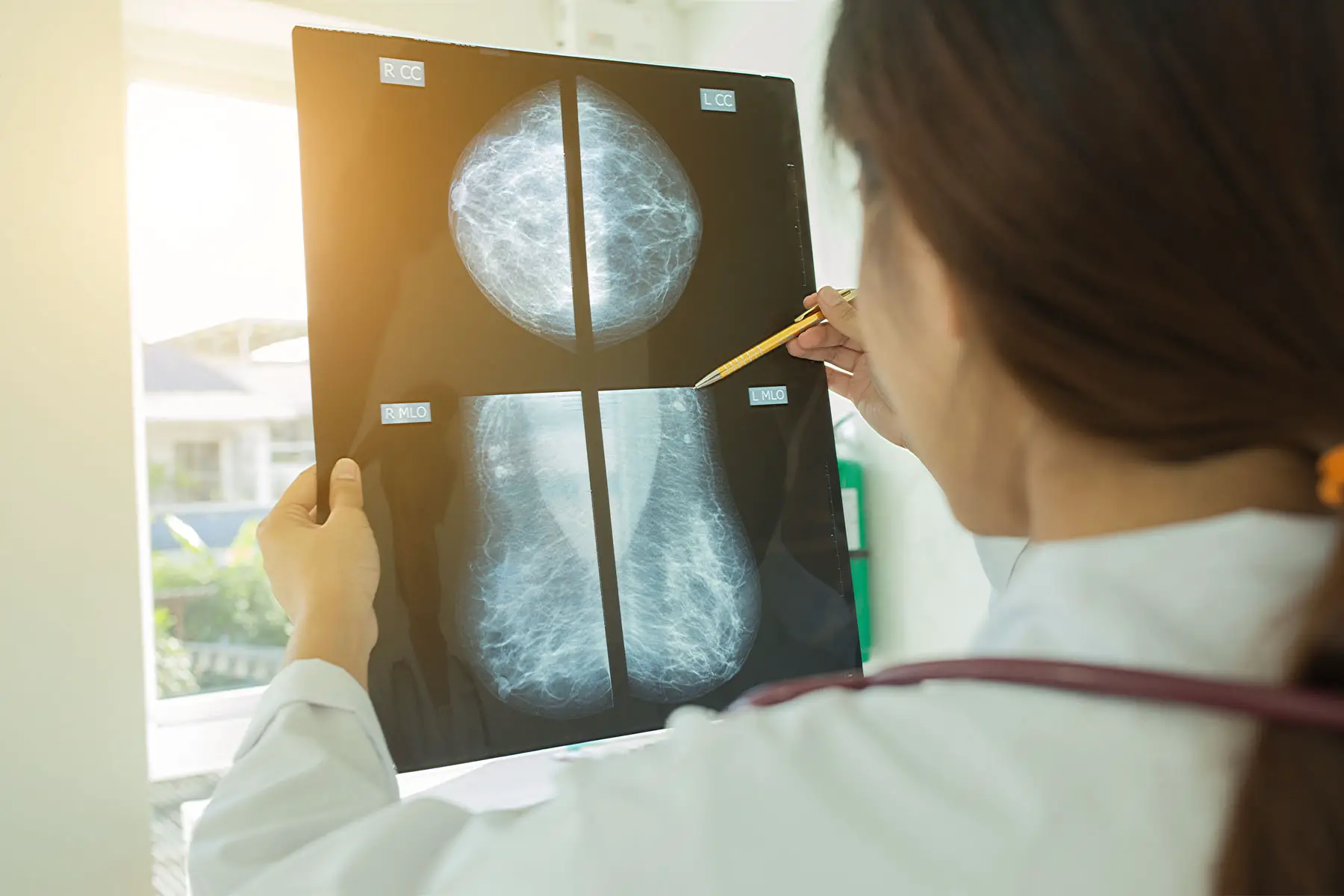 Luxembourg women's healthcare: a doctor examines a mammogram