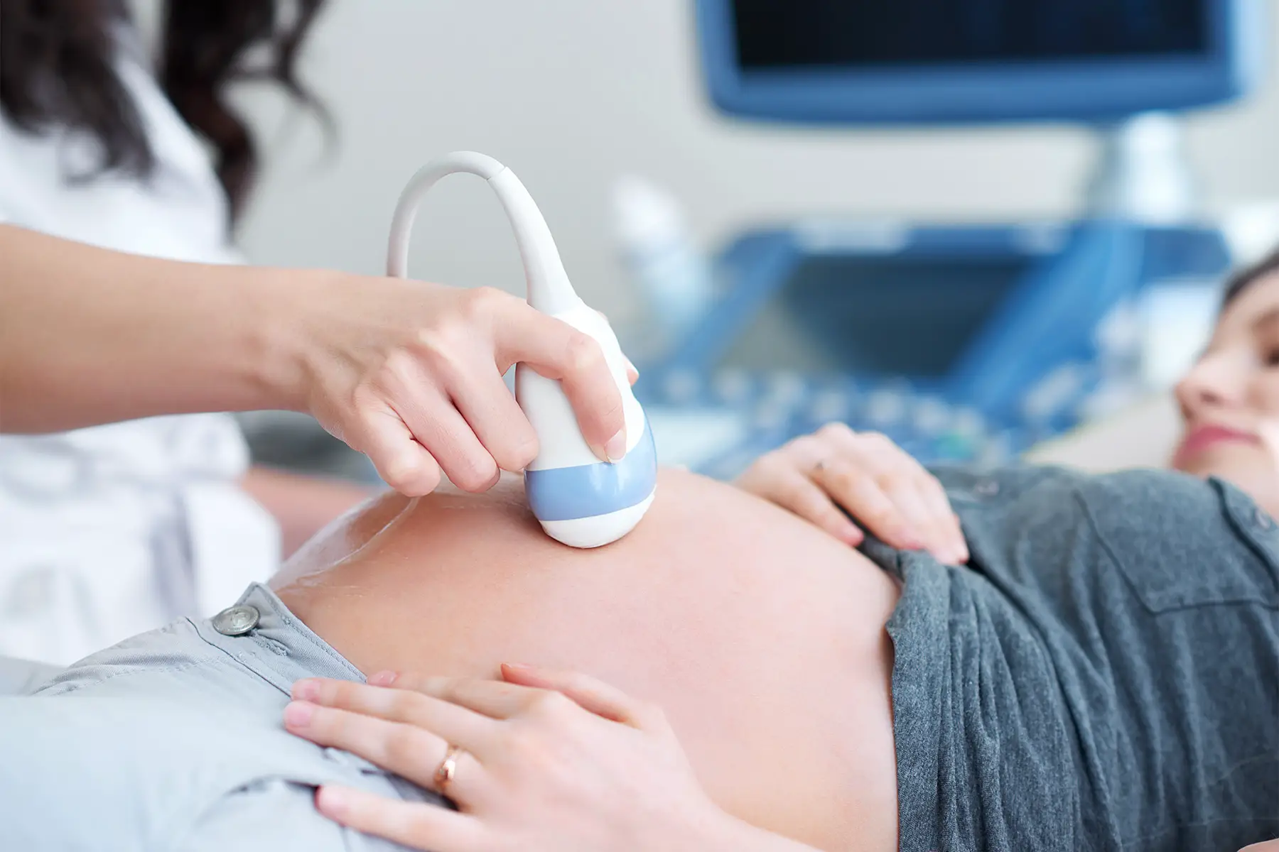 a pregnant woman having an ultrasound at a medical clinic