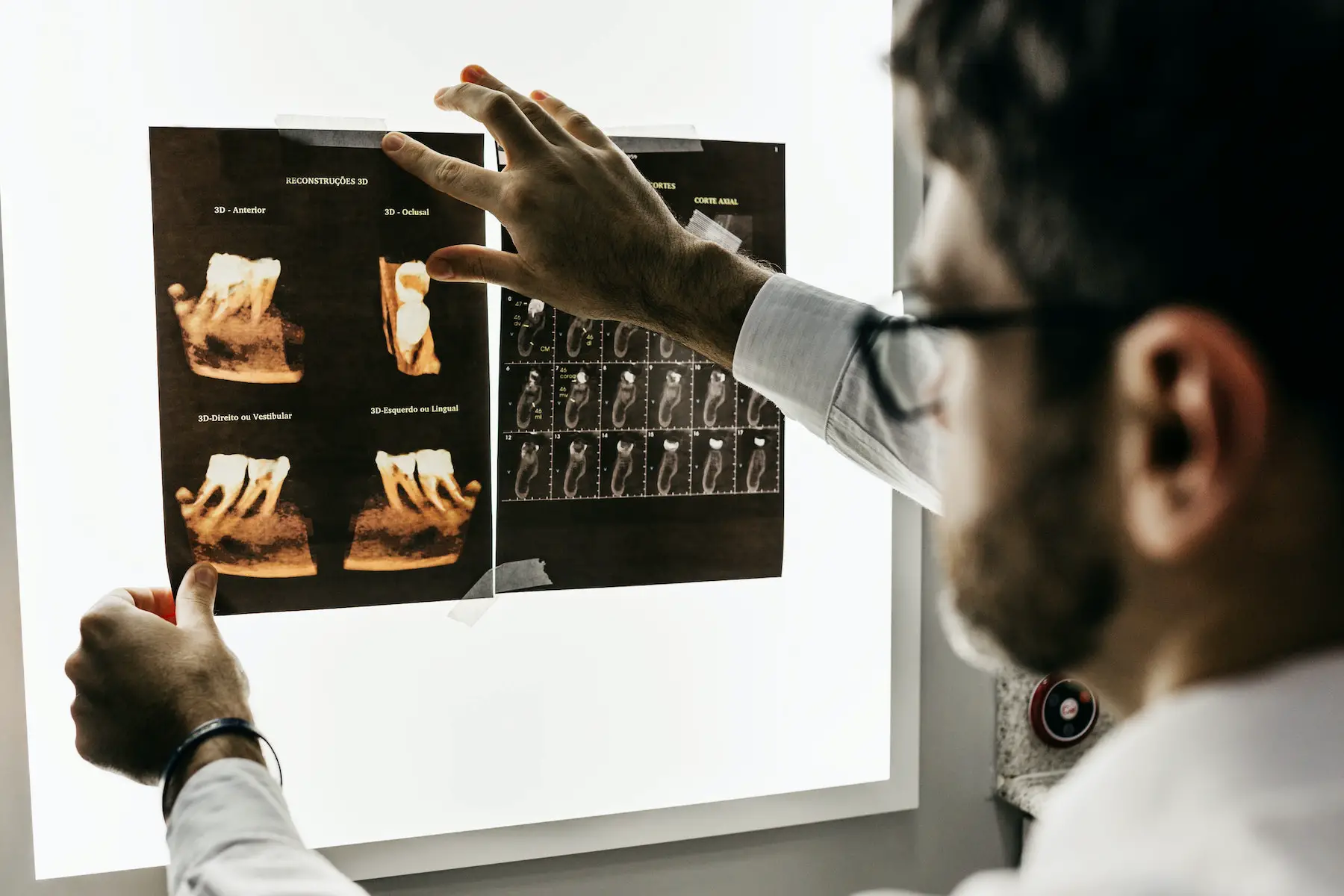 dentist checking x-ray of patient's teeth on lightbox