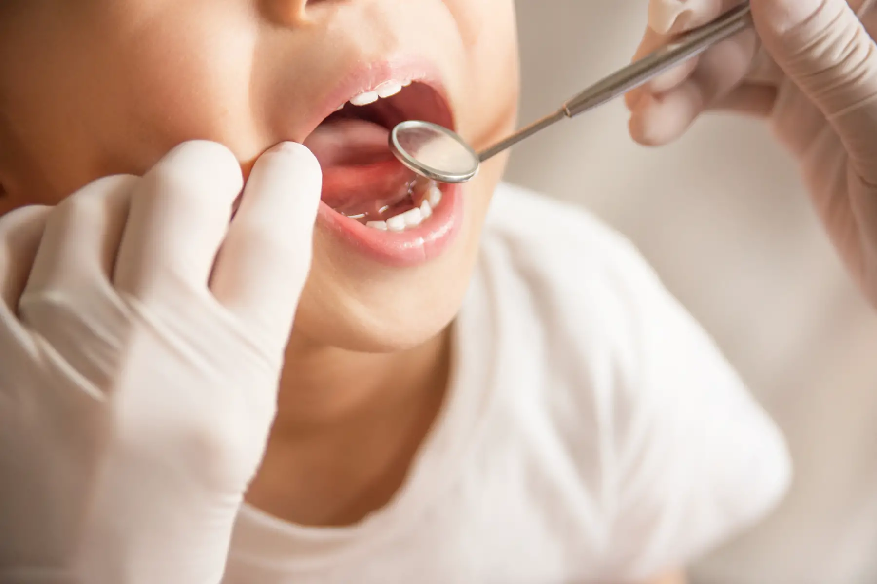 a child having a dental check-up