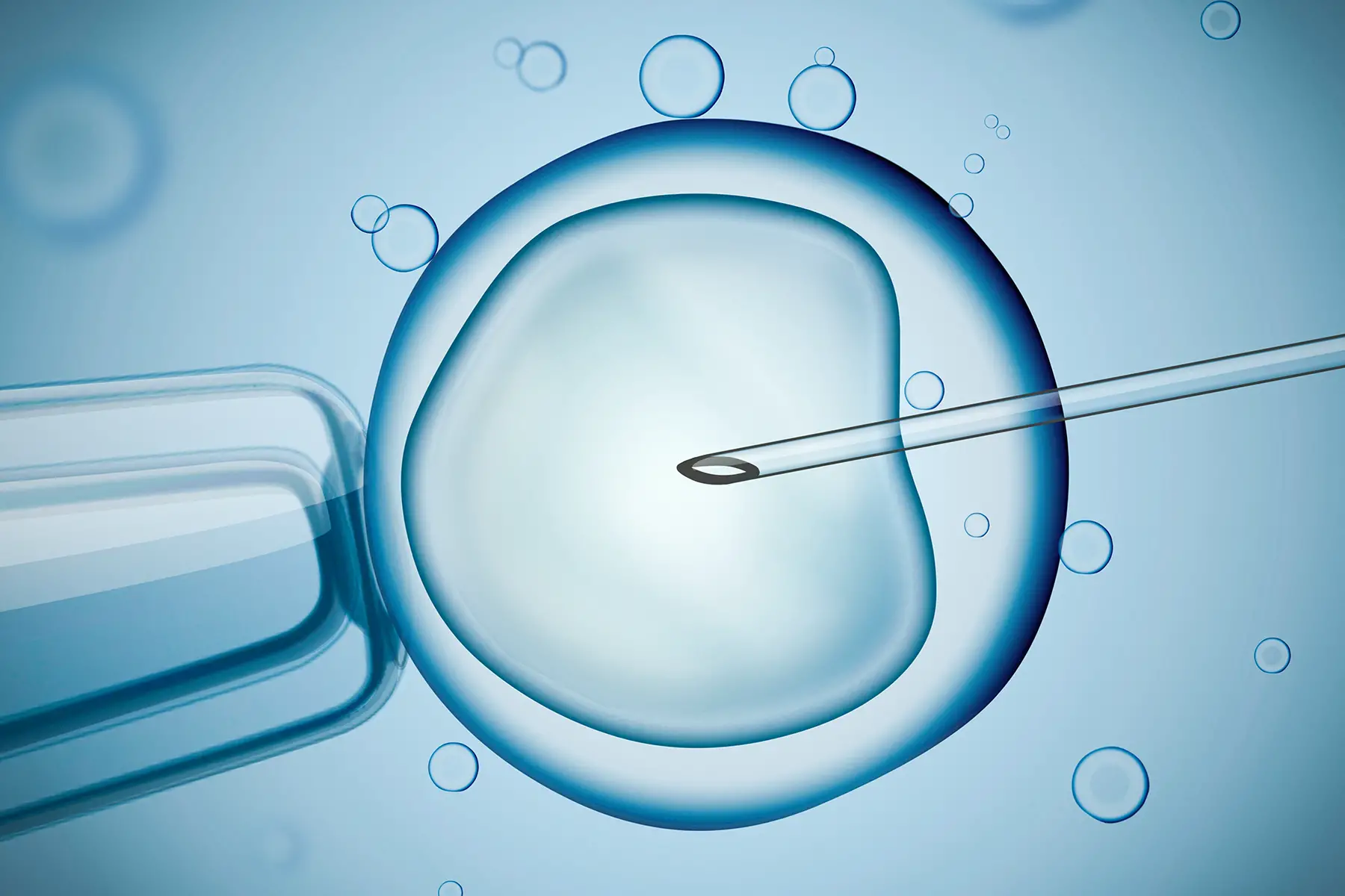 womens health uk: in vitro fertilization